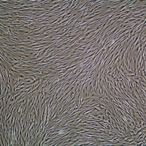 Dermal Fibroblasts